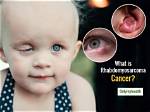 Ryan Peniston and Rhabdomyosarcoma Eye Cancer Update, What Happened?