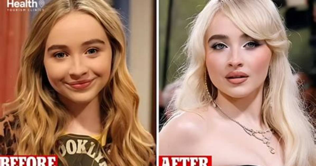 Sabrina Carpenter Before Plastic Surgery: a Journey Through Time