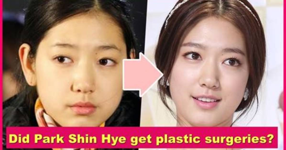 Shin Hye Sun Plastic Surgery: the Truth Revealed