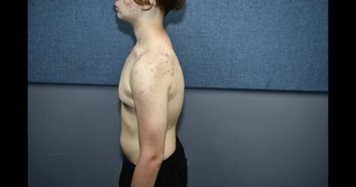Startling Details Emerge in Trystan Bailey Autopsy Report Unveiling Shocking Insights