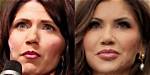 The Definitive Guide to Noem Plastic Surgery: Enhance Your Look, Boost Confidence