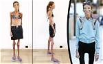 The Remarkable Journey of the Thinnest Person in the World