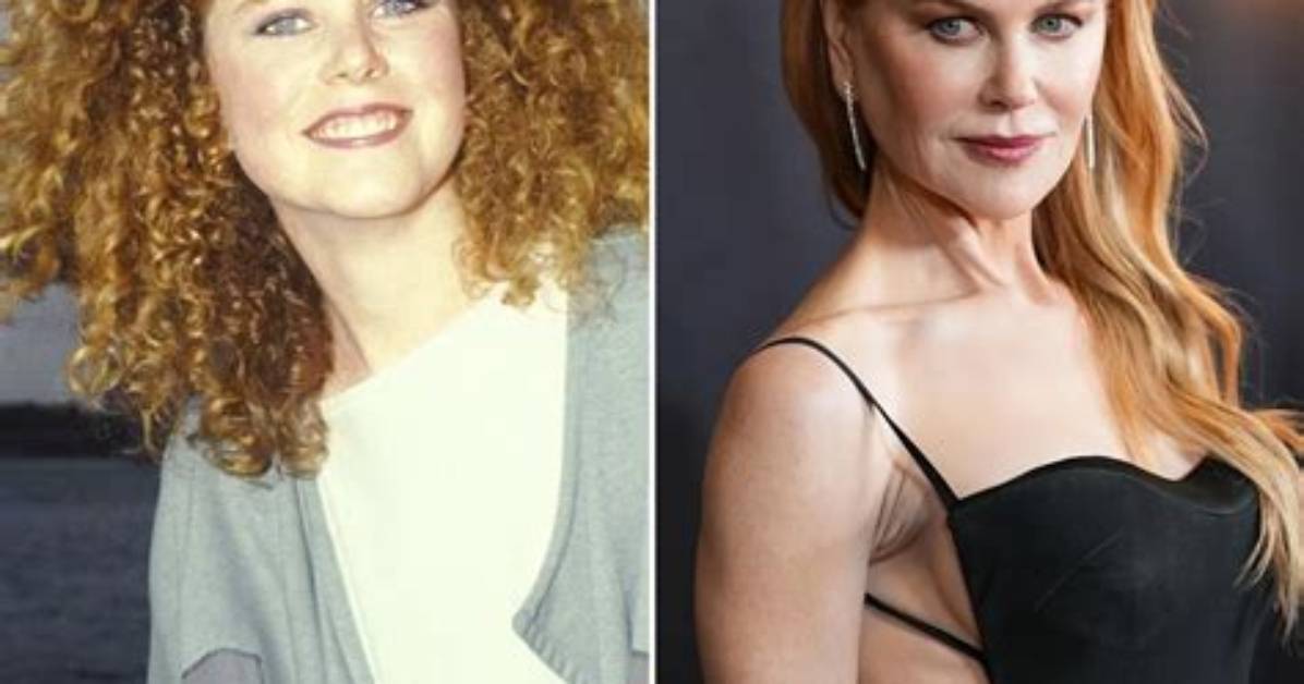 The Stunning Transformation: Nicole Kidman's Post-Surgery Journey