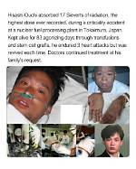 The Tragic Case of Hisashi Ouchi: a Deep Dive into His Injuries