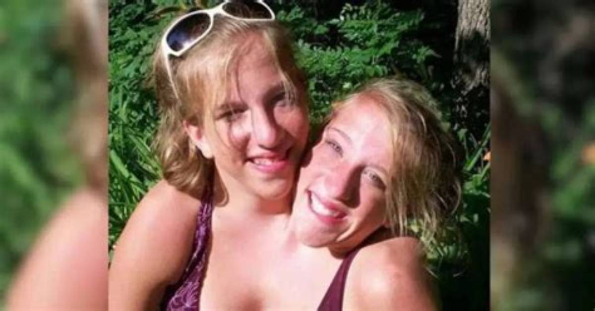 The Tragic Story of the Hensel Conjoined Twins: Abby and Brittany