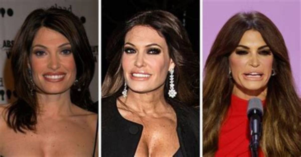 The Transformation Journey of Kimberly Guilfoyle: Unveiling Cosmetic Surgery Secrets