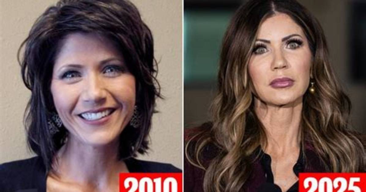The Transformation of Kristi Noem: Exploring the Filler Phenomenon