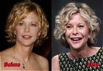 The Untold Story of Meg Ryan's First Husband