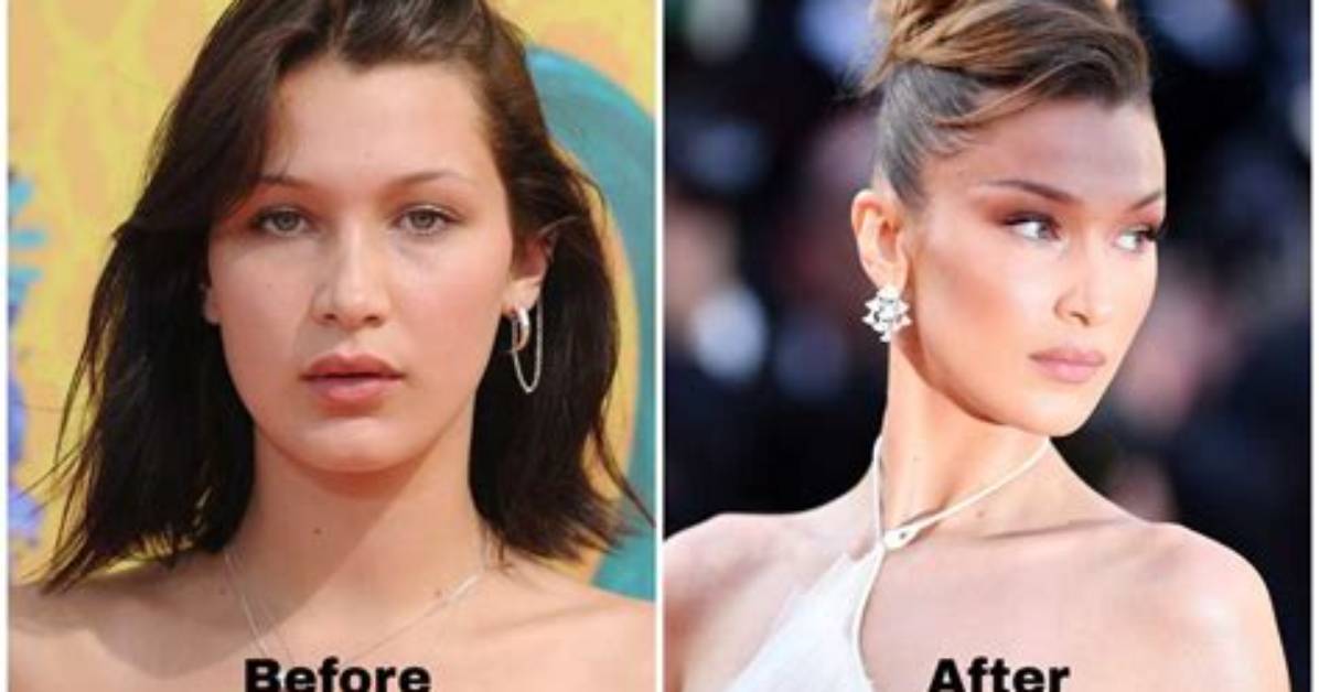 Transformation Journey: Before and After Bella Hadid