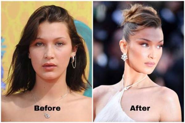 Transformation Journey: Before and After Bella Hadid