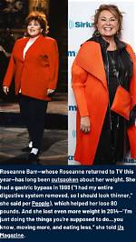 Transformations of a Comedian: Roseanne Before and After Plastic Surgery