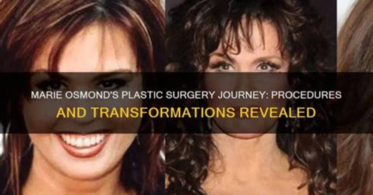 Transformations Revealed: the Journey of Actress Plastic Surgery Before and After