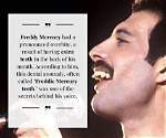 Truth About Freddie Mercury’s Teeth That Gave Him His Unique Smile