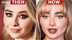 Understanding Sabrina Carpenter's Surgery Journey