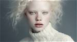 Understanding the Unique Beauty of Ginger Albino