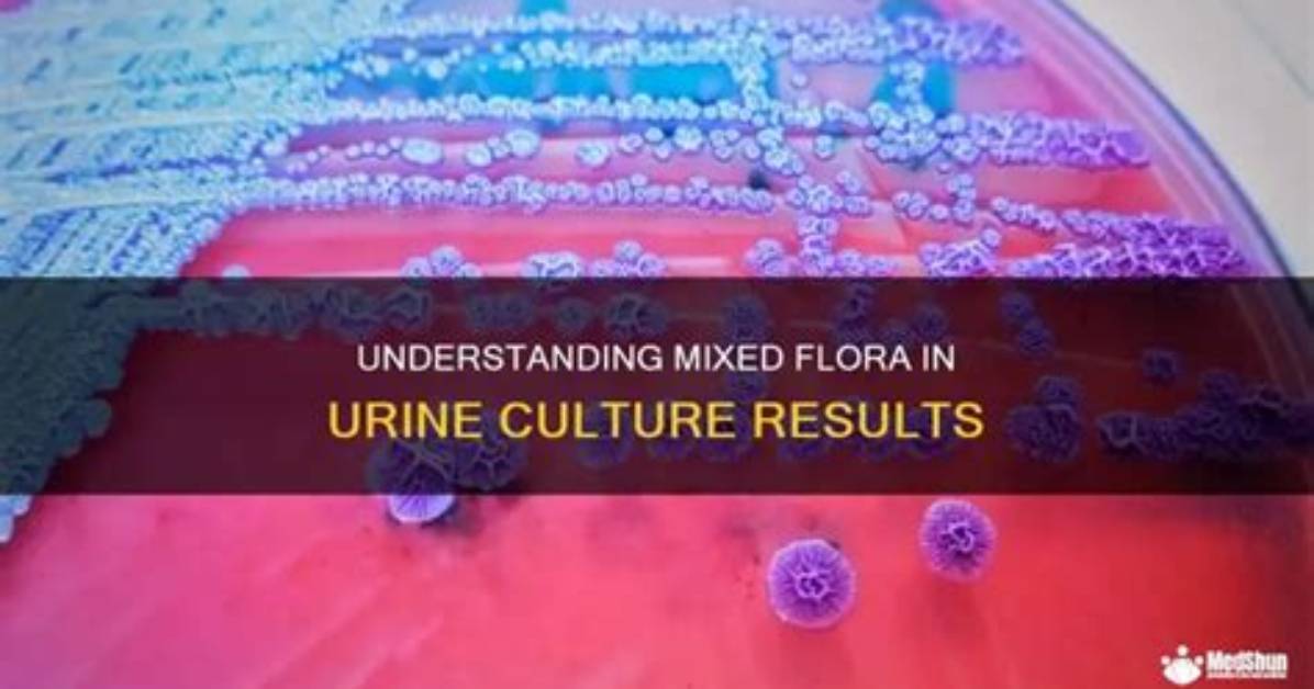 Understanding Urine Culture with Normal Skin Flora: Implications for Treatment