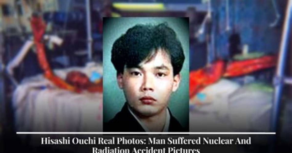 Unlocking the Secrets of the Ouchi Body: a Journey to Wellness