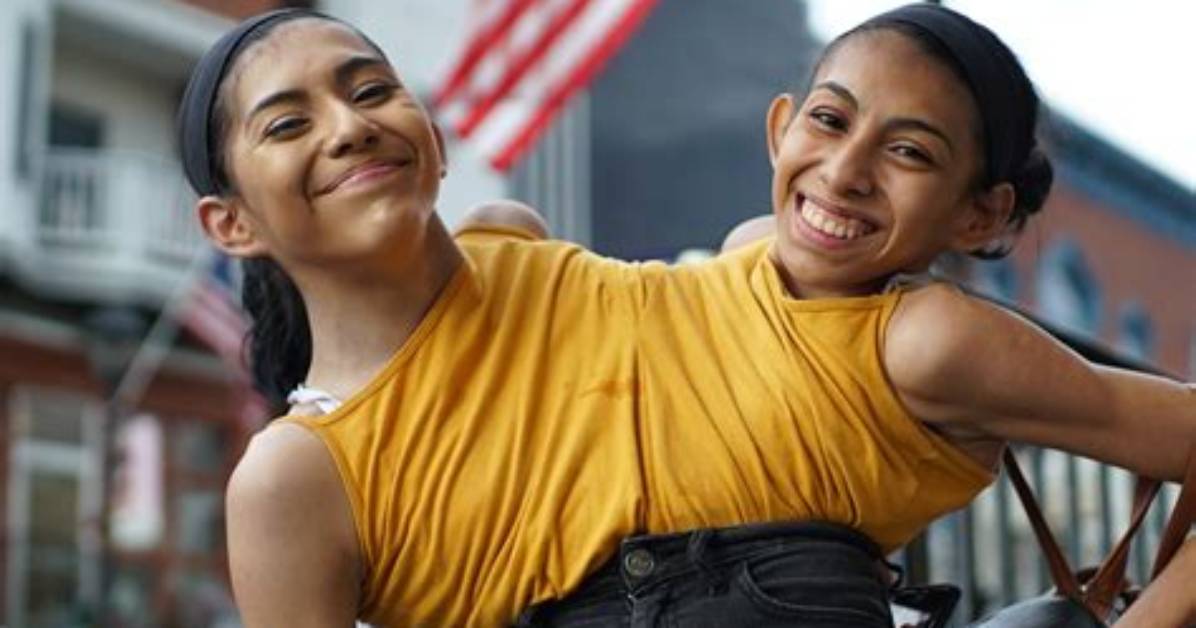 Unraveling the Heartbreaking Journey of Conjoined Twins Abby and Brittany
