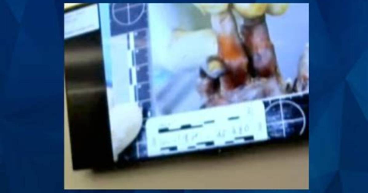 Unraveling the Mystery: the Gannon Stauch Autopsy Photos Leaked Case