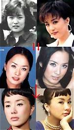Unraveling Uhm Jung Hwa's Plastic Surgery Journey