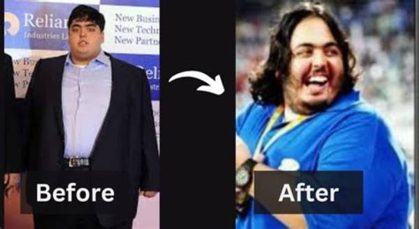 Unveiling Anant Ambani's Stomach: a Journey of Health and Transformation