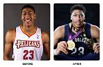 Unveiling Anthony Davis' Dental Transformation: Discoveries and Insights