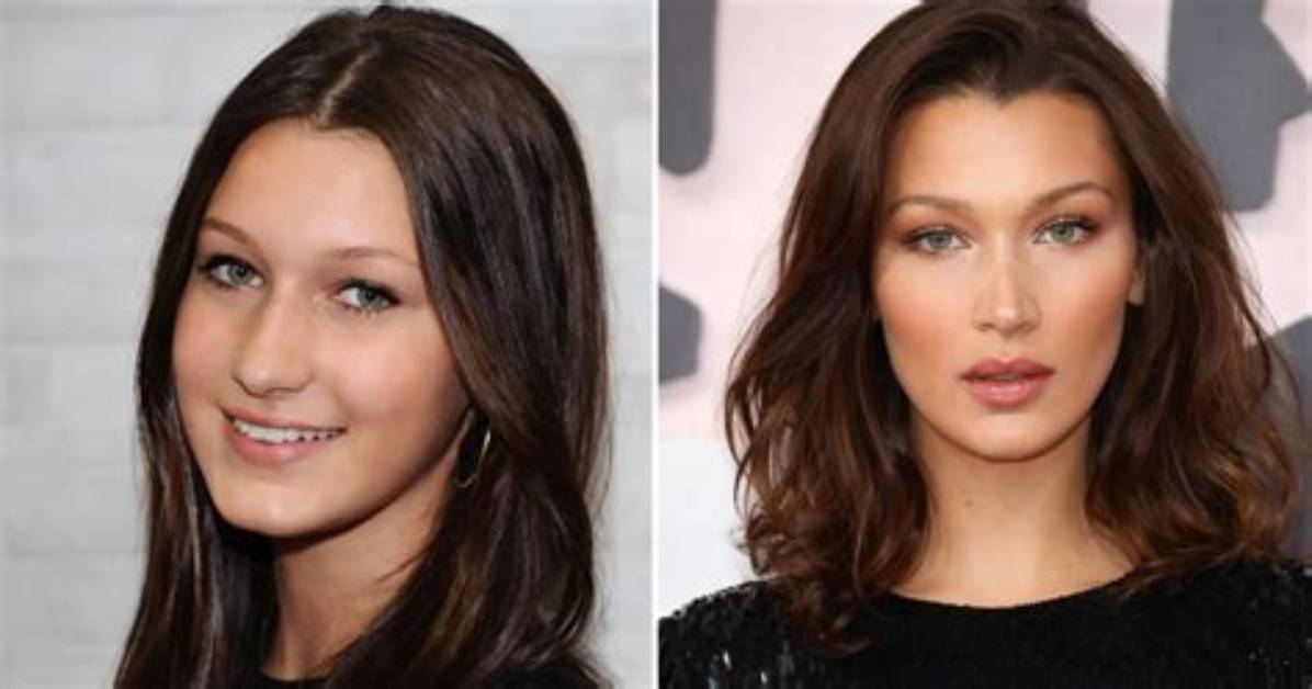 Unveiling Bella Hadid: a Glimpse Before Plastic Surgery