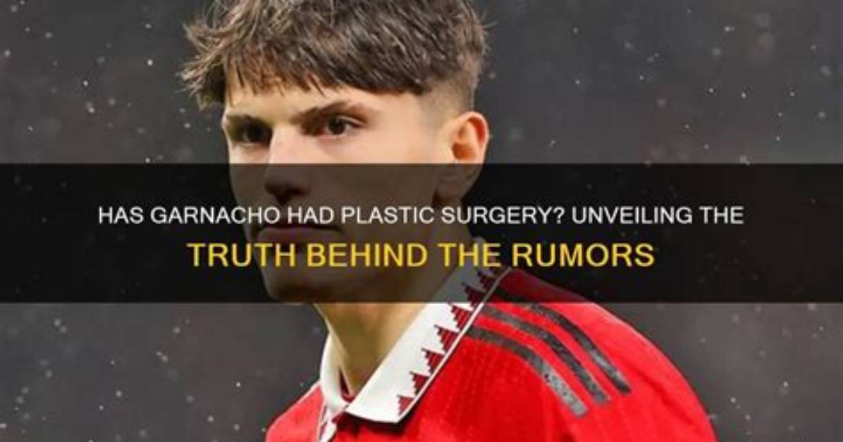 Unveiling Garnacho: the Truth Behind His Face Surgery