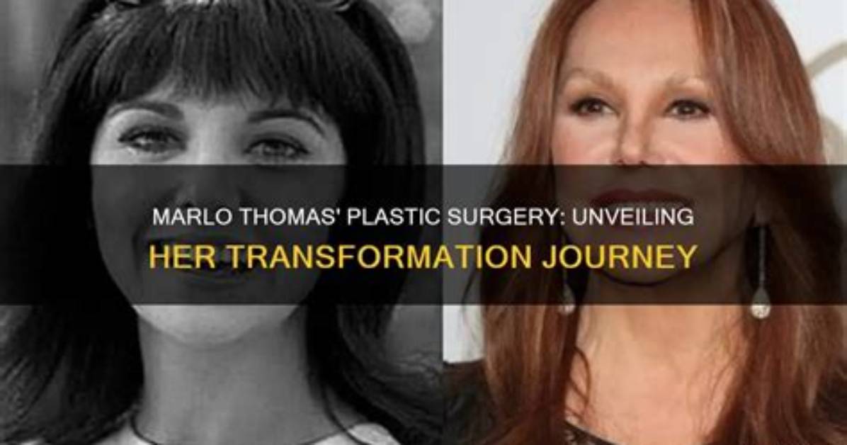 Unveiling Marlo Thomas' Health Journey: Discoveries and Insights