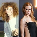 Unveiling Nicole Kidman's Radiant Transformation: a 2024 Facelift
