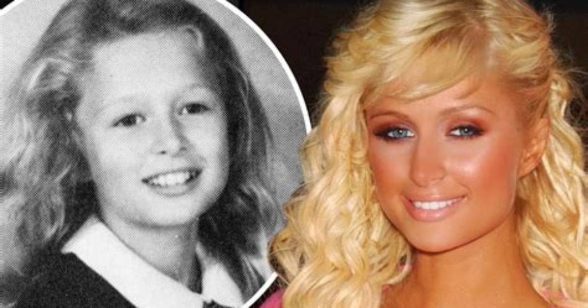 Unveiling the Before: Paris Hilton's Transformative Journey