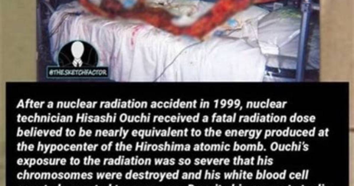 Unveiling the Reality: Hisashi Ouchi Photos of Skin