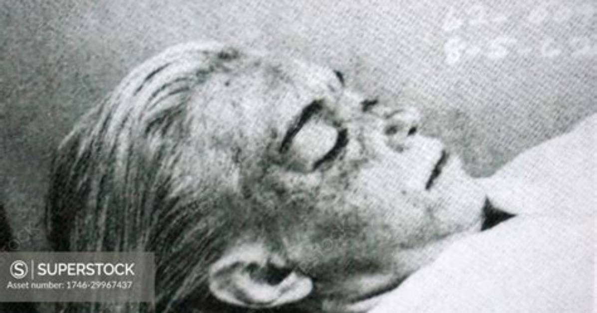 Unveiling the Secrets: Marilyn Monroe Autopsy Photos