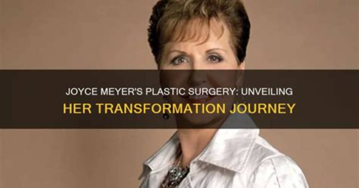 Unveiling the Secrets of Joyce Meyer Cosmetic Surgery: Discoveries and Insights