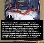 Unveiling the Tragic Journey: Hisashi Ouchi After Radiation Picture