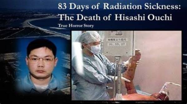 Unveiling the Tragic Journey: Hisashi Ouchi's Medical Report