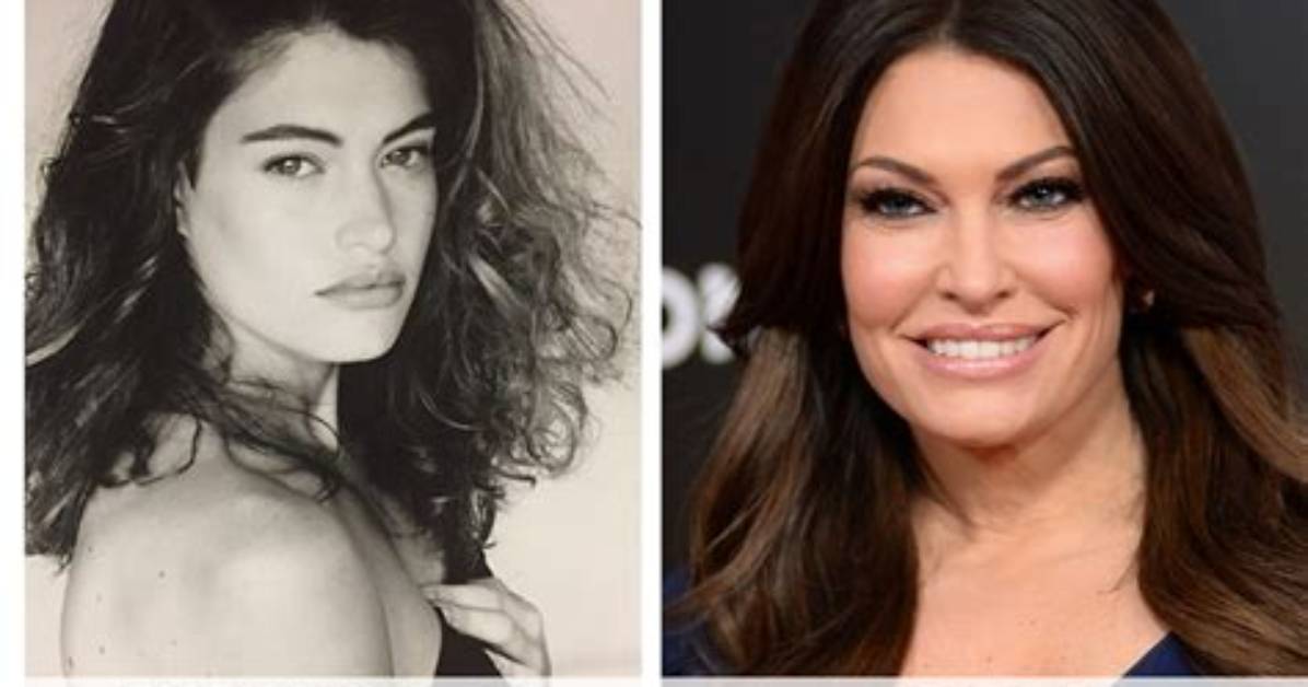 Unveiling the Transformation: Kimberly Guilfoyle Plastic Surgery Photos