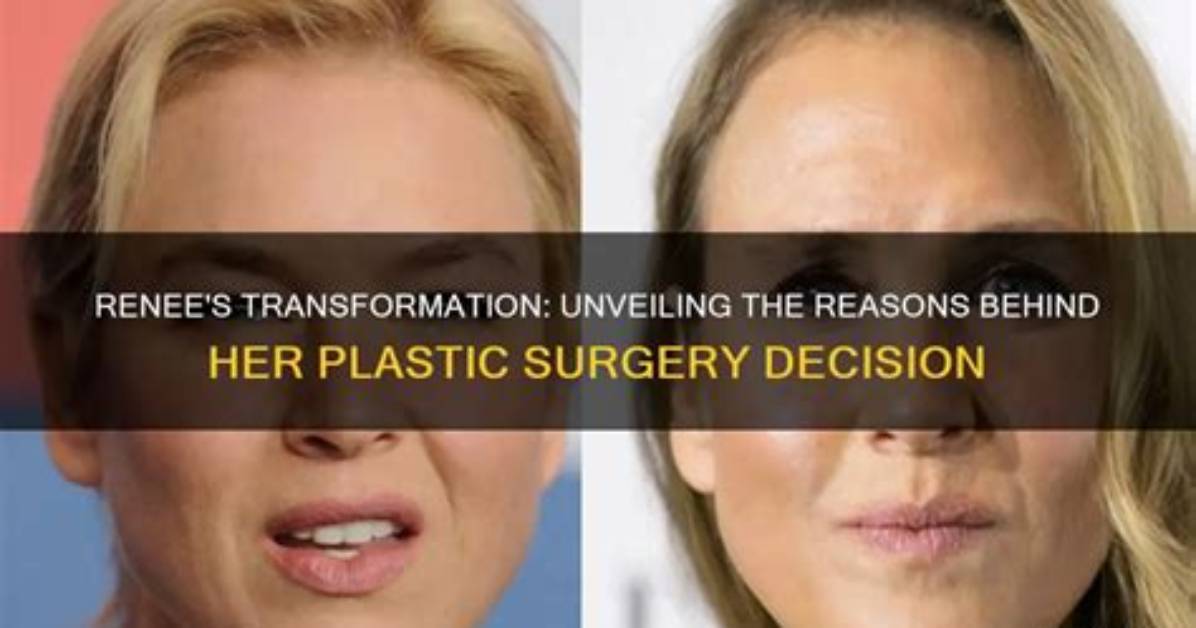 Unveiling the Transformative Journey: Brandy Renee Surgery