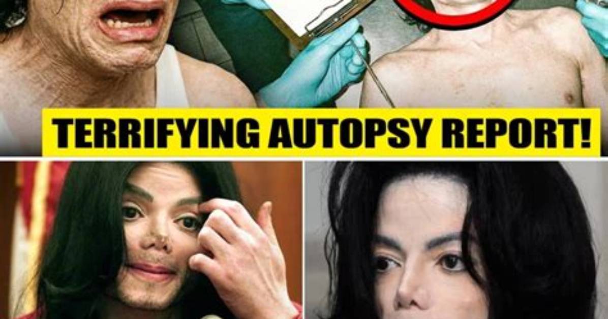 Unveiling the Truth: Autopsy Photos of the Notorious King Bon
