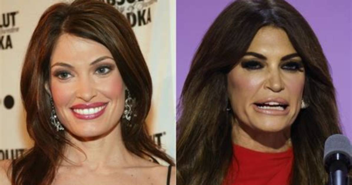 Unveiling the Truth Behind Kimberly Guilfoyle Lip Surgery