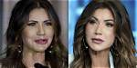 Unveiling the Truth: Christy Noem's Plastic Surgery Journey