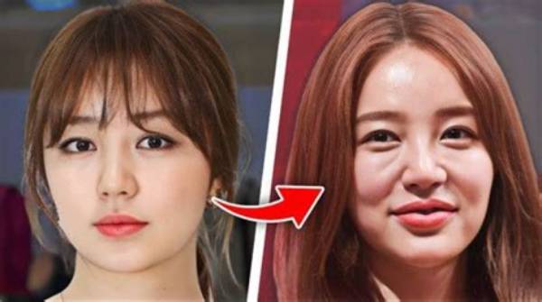 Unveiling the Truth: Do Korean Actors Get Plastic Surgery?