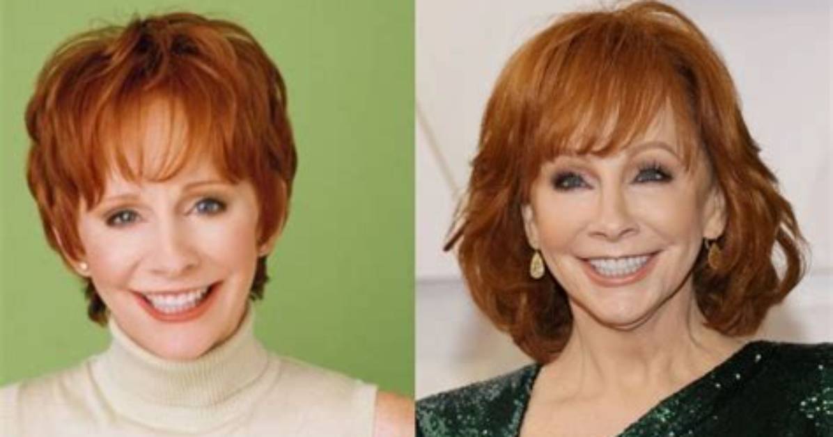 Unveiling the Truth: Reba's Plastic Surgery Journey