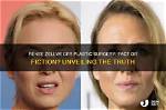 Unveiling the Truth: Renee's Realm Leaks Exposed