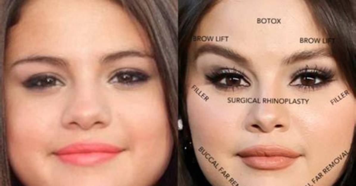 Unveiling Truths and Speculations Surrounding Selena Gomez's Pregnancy Rumors