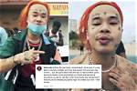 Was Rapper Kid Trunks Shot in the Face?