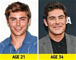 What Did Zac Efron Do to His Face? Injury or Plastic Surgery, Why Did His Face Change?