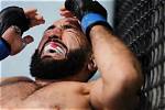 What Happened to Belal Muhammad Eye? Details on His Face Injury and Update Today