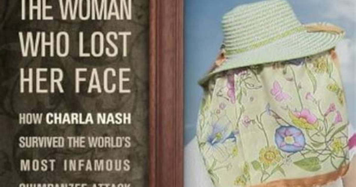 What Happened to Charla Nash? Is Charla Nash Blind?