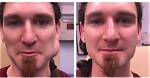 What Happened to Kevin Olaeta? Dr Pimple Popper Patient Passed Away